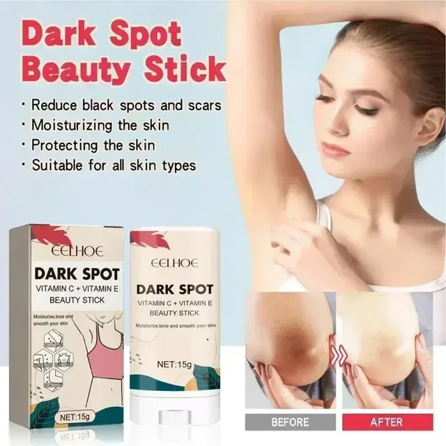 Crema blanqueadora para eliminar manchas oscuras y Corrector, crema suave y segura para aclarar la piel, crema blanca para las axilas y el cuello