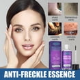 thumbnail image 1 of Líquido para eliminar verrugas, líquido para eliminar la piel del cuello, excrecencia de la piel Facial, líquido acuminado axilar, 30ML, 1,01 FLOZ, 1 of 4