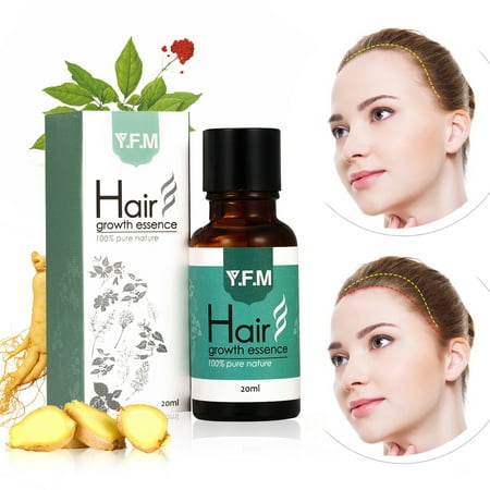 On Sale Hair Growth Essence Herbal Hair Growth Liquid Can Help