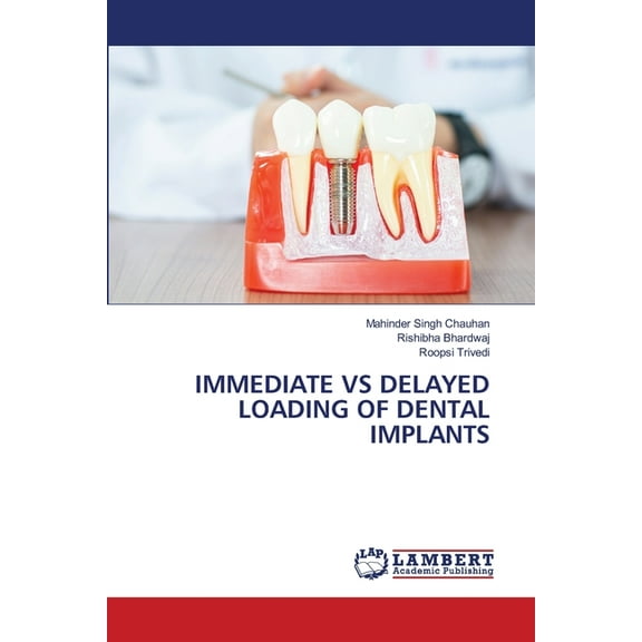 Immediate Vs Delayed Loading of Dental Implants, (Paperback)