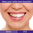 thumbnail image 3 of V34 Teeth Whitening Toothpaste Cleans Teeth Stains, Protects Gums, Whitens Teeth, Oral Car, 3 of 5