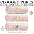 thumbnail image 5 of Jaysuing Blackhead Removal Essence Moisturizes And Tightens The Skin, Shrinks Pores, Deeply Cleans And Removes Blackheads |, 5 of 5