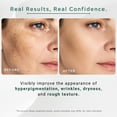 thumbnail image 5 of Gutaderme Vitamin C + Niacinamide Serum for Face-Dark Spot, Hydration, Radiance, Hyperpigmentation, Blemishes, Skin Texture & radiance & Hylunaric Acid Moisturizer, 30ml/f1 oz, 5 of 10