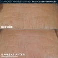thumbnail image 6 of RoC Retinol Correction, Deep Wrinkle, Rich Cream 1.7oz, 6 of 13
