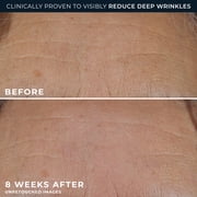 RoC Retinol Correction, Deep Wrinkle, Rich Cream 1.7oz