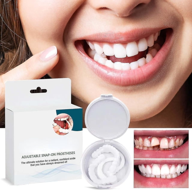 Adjustable Snap On Prothesens, Adjustable Snap On Denture, Silicone Whitening Denture Braces, Cover The Imperfect Teeth yy