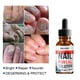 thumbnail image 3 of 2 uds líquido para reparación de uñas, tratamiento de hongos en las uñas de los pies, restauración de uñas quebradizas amarillas para (10ml), 3 of 5