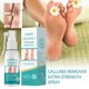 thumbnail image 5 of Spray Exfoliante onlyliua para el Hogar Cuidado de Pies Suaviza Queratina 20ML, 5 of 7