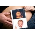thumbnail image 4 of SONY THERMAL PRINT PACK LARGE UPC-21L, 4 of 4