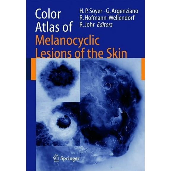 Color Atlas of Melanocytic Lesions of the Skin, (Hardcover)