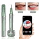 thumbnail image 2 of Home Ultrasonic Calculus Remover Dental Scaling Electric Portable Scaler Sonic Smoke Stains Tartar Plaque Teeth White, 2 of 5