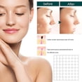 thumbnail image 4 of Parches para eliminar verrugas cutáneas con ingredientes naturales, seguros y eficaces, y fórmulas mejoradas., 4 of 4