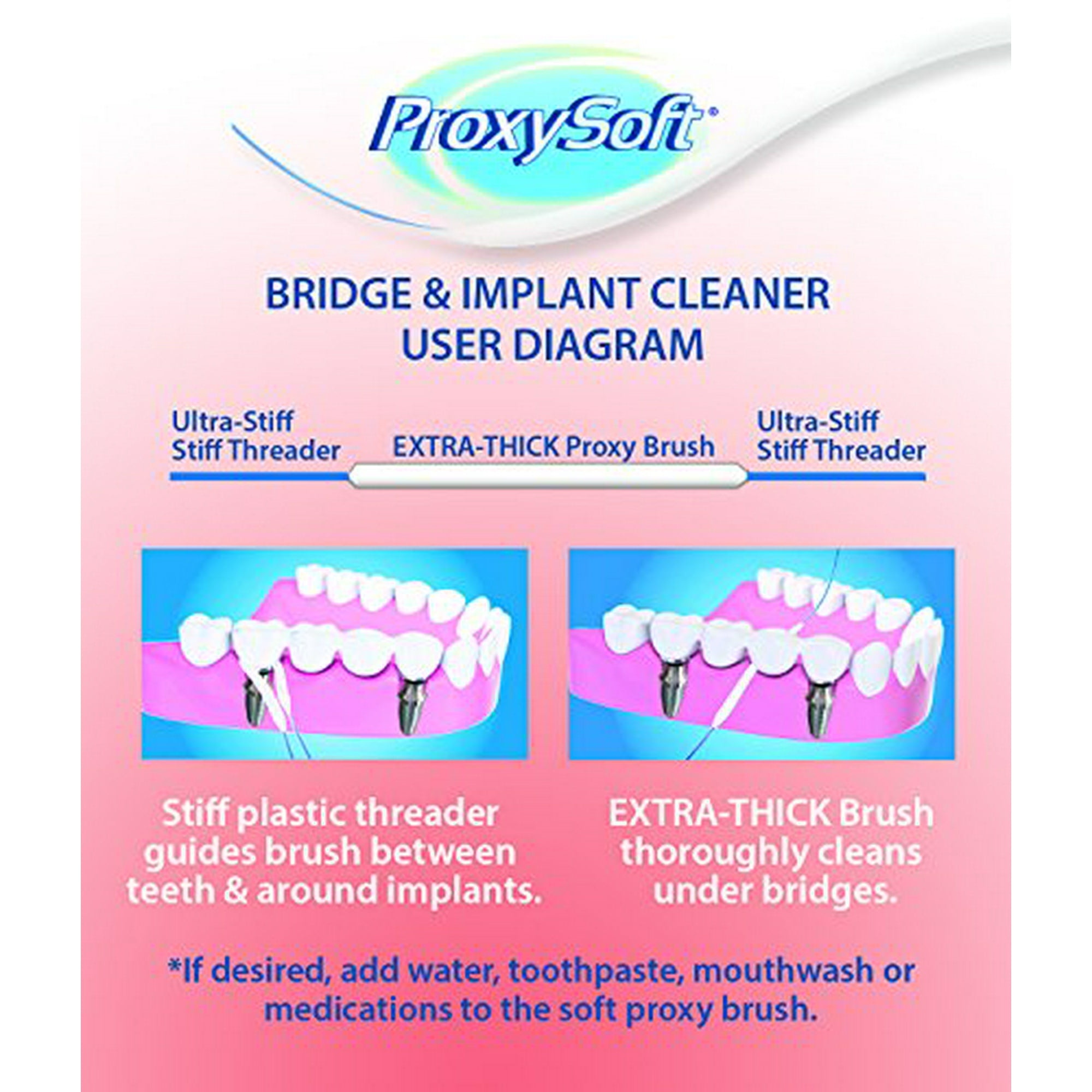 How To Use Dental Floss For Bridges Best Image