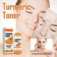 thumbnail image 2 of Xihbxyly Tónico de Limón y Cúrcuma, Limpiador Facial Iluminador, Gel de Ducha Reafirmante, Mascarilla de Doble Efecto Blanqueador, Apto para Cuerpo y Rostro, Suave para Todo Tipo de Piel, Fórmula Nat, 2 of 7