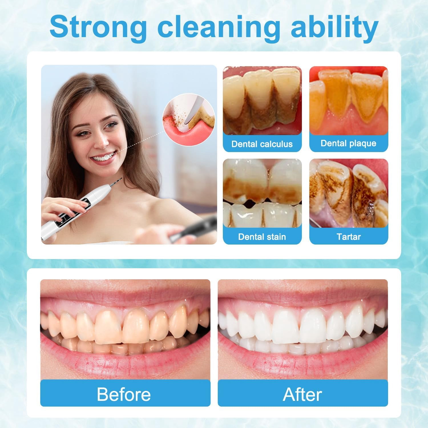 GKcity Plaque Remover for Teeth, Teeth Cleaning Kit, Ultrasonic Electric Teeth Cleaner with LED Light, 3 Adjustable Modes, 2 Repalceable Heads, Calculus Tartar Plaque Remover for Human Teeth