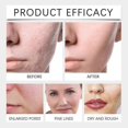 thumbnail image 3 of ExquisiteSS Collagen Reverse Volume Peel Off Face Mask, Collagen Face Mask, Hydrolyzed Collagen 380 Dalton Face Mask, 3 of 3
