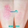 thumbnail image 3 of Jabón Para Psoriasis y Dermatitis, Dermabon 1 pza, 3 of 5