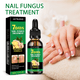 thumbnail image 3 of Jaysuing Ginger Nail Care Solution Cuidado suave para uñas suaves de manos y pies, superficie plana de las uñas, solución hidratante e iluminadora, 3 of 13