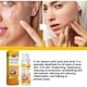 thumbnail image 3 of Crema Para El Acné Quístico Crema de eliminación de acné quístico de 30 ml, reparación hidratante antiacné, blanqueamiento de la piel Sywqhk Cuidado Belleza, 3 of 7