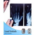 thumbnail image 3 of Xray Markers with Lead Initials - Glitter Radiology X-ray Markers in Rose & Green "L&R" Letter Shape Include Reusable Adhesive Tapes to Nurse Radiologist Badge Buddy, Easy to Identify, 3 of 6