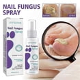 thumbnail image 2 of Medinail nail fungus treatment spray 100ml for soft nails, 2 of 5