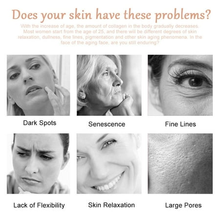 Sonew Machine De Beaute De Rajeunissement De Peau D Oeil De Visage De Rf D Oeil Magique D Instrument De Rf Machine De Rajeunissement De Peau De Rf Soin Des Yeux Machaine Walmart Canada Sonew Machine De Beaute De Rajeunissement De Peau D Oeil De Visage De Rf D Oeil Magique D Instrument De Rf Machine De Rajeunissement De Peau De Rf Soin Des Yeux Machaine Walmart Canada