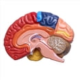 thumbnail image 3 of 4X Modelo AnatóMico Cerebral AnatomíA 1: 1 Medio Cerebro Tallo Cerebral Suministros de Laboratorio de Enseñanza MéDica, 3 of 5