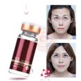 thumbnail image 1 of 10ml Concentrado De Seis Péptidos Blanqueador Antienvejecimiento Antiarrugas Elimina El Aceite De Belleza De Pecas, 1 of 7