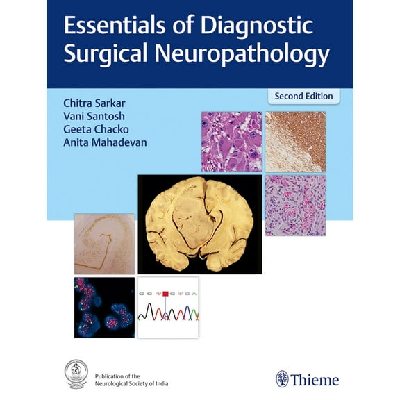 Essentials of Diagnostic Surgical Neuropathology, (Hardcover)