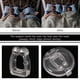 thumbnail image 3 of Mini Audífonos Nasales ANGGREK Clip Nasal Magnético Antiapnea Y Antironquidos Para Hombres Y Mujeres, 3 of 7