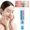 Acne Scars Remover for Face Pimples Acne Remover Scar Gel Pimple Marks