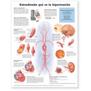 Understanding Hypertension Anatomical Chart in Spanish (Entendiendo Que Es la Hypertension)