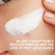 (2 pack) CeraVe Clay to Foam Acne Facial Cleanser, Mask & Spot Treatment for Acne Prone Skin 4 oz