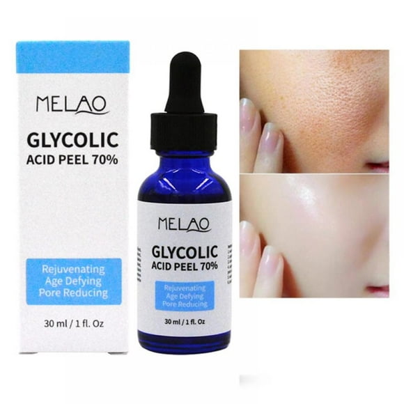 Glycolic Acid Stretch Marks