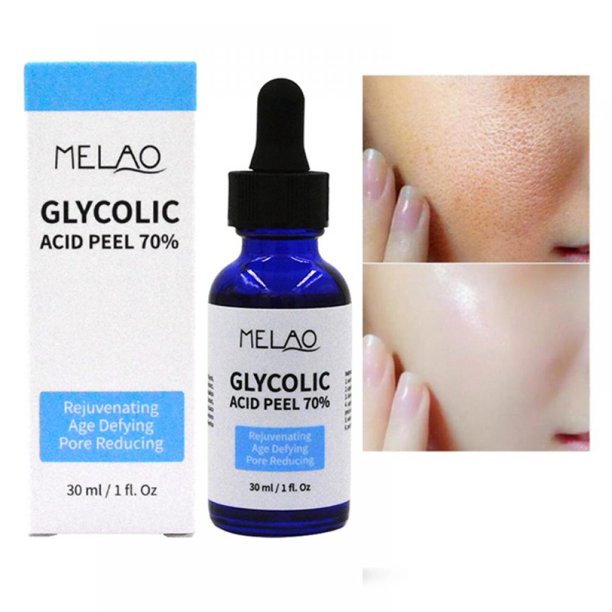 Glycolic Acid Peel 70 Pro Skin Peel Age Defying, Erase Wrinkles