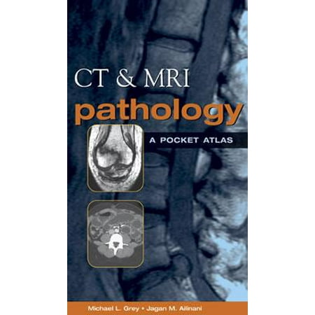 UPC: 9780071380409 | CT & MRI Pathology : A Pocket Atlas (Paperback)