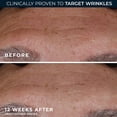 thumbnail image 4 of RoC Deep Wrinkle Serum, 1 Ounce, 4 of 9