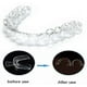 thumbnail image 4 of New Transparent Night Guard Gum Shield Mouth Trays For Bruxism Teeth Whitening Grinding For Boxing Teeth Protection Equipment--, 4 of 5