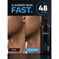 thumbnail image 4 of Bump Patrol Original Formula Aftershave Treatment Serum – Razor Bump Stopper and Ingrown Hair Treatment for Men and Women, Ingrown Hair Serum with Salicylic Acid - 2 oz (Pack of 1), 4 of 5