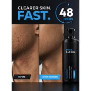 Bump Patrol Original Formula Aftershave Treatment Serum – Razor Bump Stopper and Ingrown Hair Treatment for Men and Women, Ingrown Hair Serum with Salicylic Acid - 2 oz (Pack of 1)