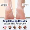 thumbnail image 2 of Crema para pies Yellow Bird Natural para reparar pies secos y agrietados, 2 of 8