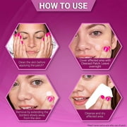2 Pack - Clearasil Stubborn Acne Control 5in1 Pimple Patch, 18 Count