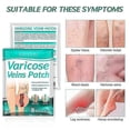 thumbnail image 4 of 2025 Varicose Veins Treatments Stickers Universal Varicose Massage Stickers for Loose Leg Vein Legs, 4 of 5