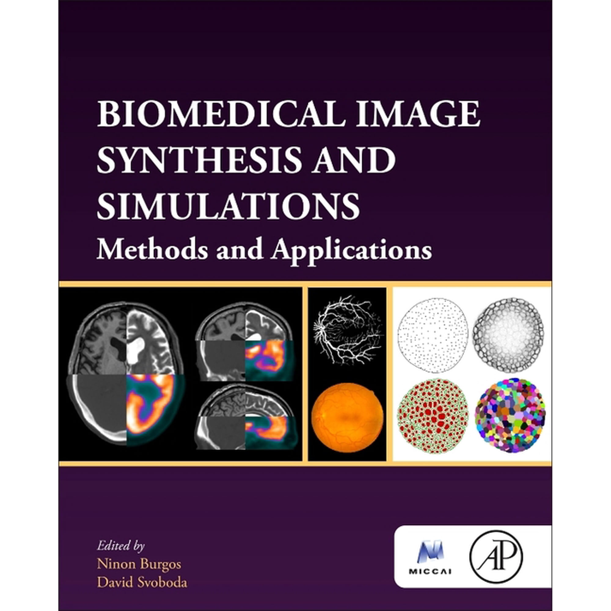 The Miccai Society Book Biomedical Image Synthesis and Simulation: Methods and Applications (Paperback)