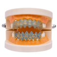 thumbnail image 1 of 8 Zircon Hip Hop Braces, Colour: Gold Lower Teeth Gold Lower Teeth, 1 of 4