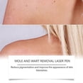 thumbnail image 3 of Portable Laser Skin Care Pen for Blemish Removal & Skin Cleansing, 3 of 5
