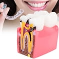 thumbnail image 4 of Modelo De Dientes, Modelo De Anatomía Dental Portátil Compacto De Resina Para El Cuidado Bucal Para Laboratorio Dental, 4 of 7