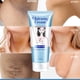 thumbnail image 1 of Crema blanqueadora de piel para piel oscura, axila, codo, rodilla, partes privadas, crema blanqueadora, elimina la pigmentación de melanina, ilumina la piel Fivean unisex, 1 of 1