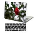 thumbnail image 3 of KSK KAISHEK Hard Case Only for MacBook Pro 13 inchs( Retina Display, 2015 2014 2013 2012) + Black Keyboard Cover Model A1425 A1502, No CD-ROM, No USB-C Rose series 0955, 3 of 5
