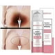 thumbnail image 2 of Insma-x Armpit Whitening Cream Skin Lightening Bleaching Cream For Underarm Dark Skin Legs Knees Whitening Intimate, 2 of 3
